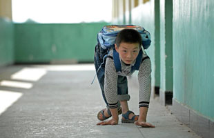 “蜗牛男孩”艰辛上学路